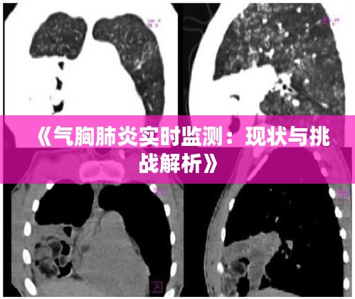 《气胸肺炎实时监测：现状与挑战解析》
