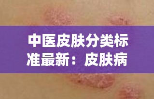 中医皮肤分类标准最新：皮肤病中医分型 