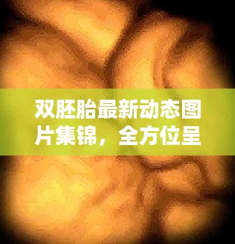 双胚胎最新动态图片集锦，全方位呈现最新信息