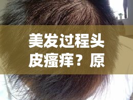 美发过程头皮瘙痒？原因解析与应对妙招！