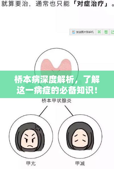 桥本病深度解析，了解这一病症的必备知识！